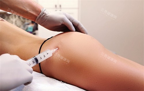 不明注射物丰臀中