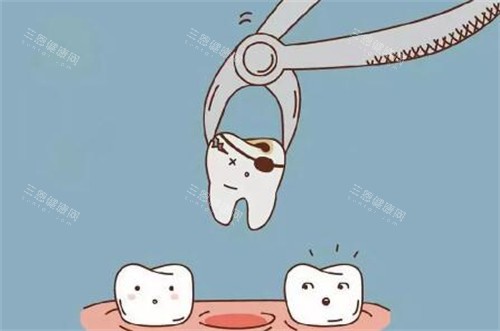 拔牙卡通图展示 拔牙卡通图展示