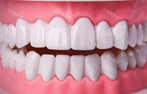 牙齿美白模型 牙齿美白模型