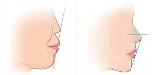 郯城县看牙避坑指南！本地人强推孙氏/良新/鑫鑫口腔，对比技术口碑+价格！