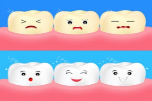 牙齿美白卡通展示