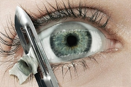 外眼角手术后露红、缺口不愈合怎么办？韩国VA整形外科&皮肤科修复方案详解！