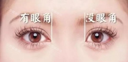 有没眼角区别