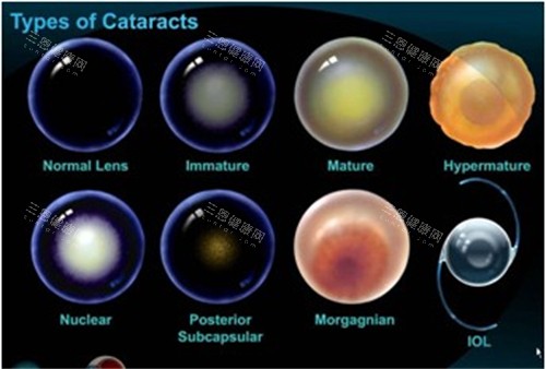 湘南学院附属医院眼科收费价格表查看，近视手术8000起/白内障3200起/斜视4800起！