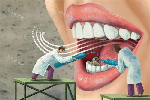 牙齿检查做治疗图 牙齿检查做治疗图