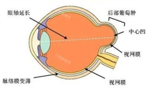 封康医生后巩膜加固术价格表：单眼15000元起，手术数量多技术好