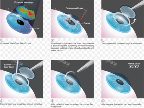 湖北恩施慧宜眼科医院超靠谱！适配恩施本地眼健康需求，技术优+收费合理，看眼不用跑远