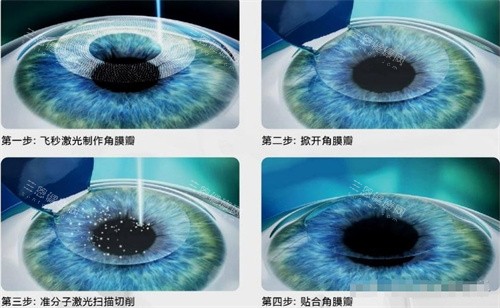 江苏南通文慈眼科口碑超稳！本地老牌眼科，验光细致、眼病治疗结果好，口碑积累久