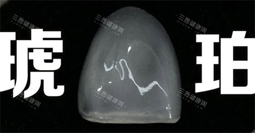 琥珀瓷贴面 琥珀瓷贴面