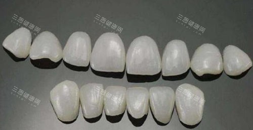 瓷贴面修复改善 瓷贴面修复改善