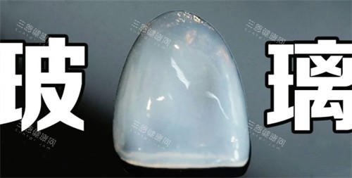 玻璃瓷贴面 玻璃瓷贴面