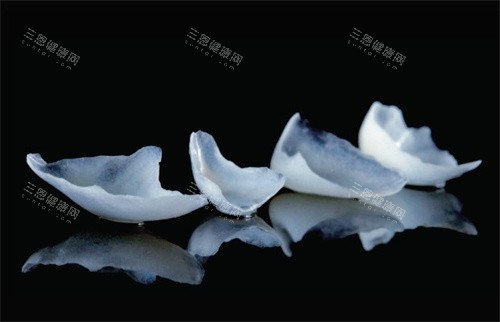 铸瓷贴面 铸瓷贴面