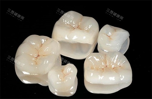 烤瓷贴面 烤瓷贴面