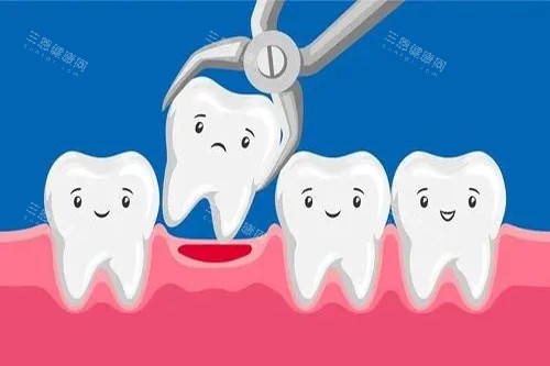 牙齿拔除卡通示意图 牙齿拔除卡通示意图