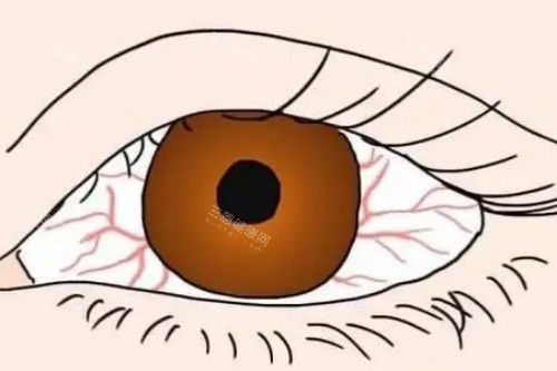 眼睛充血卡通图 眼睛充血卡通图