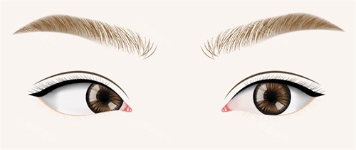 斜视眼睛和正常眼睛 斜视眼睛和正常眼睛