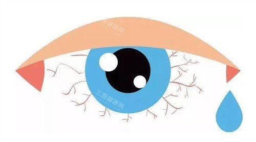 眼睛干涩 眼睛干涩
