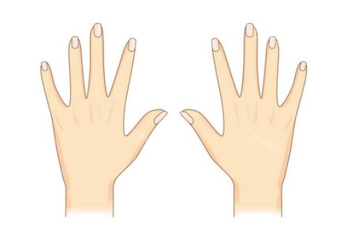 手背拉皮术后示意图