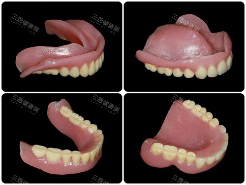 全口吸附性义齿3万贵吗？按10年寿命算，年均成本比传统假牙还低