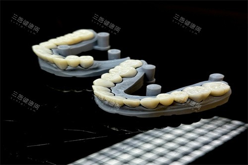 假牙的模型样子