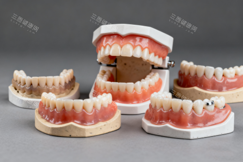 假牙模型图片展示 假牙模型图片展示