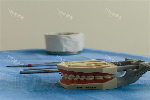假牙制作过程模型展示 假牙制作过程模型展示