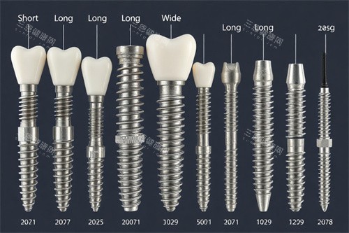 种植牙不同类型图