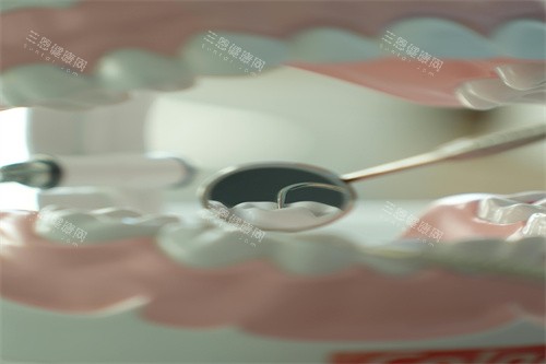 牙齿治疗细节展示 牙齿治疗细节展示