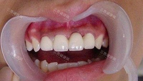 即墨三医牙科哪个大夫好？300+患者推荐这几位，附真实治疗反馈