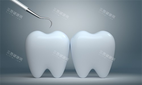 牙齿检查 牙齿检查