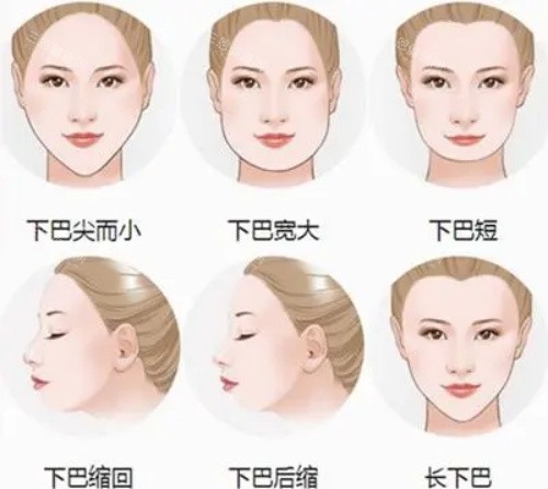 下巴的类型 下巴的类型