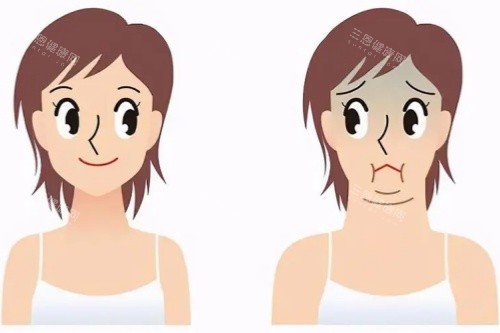 双下巴消除卡通对比图 双下巴消除卡通对比图