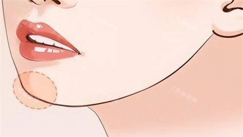 下巴填充对比 卡通 下巴填充对比 卡通