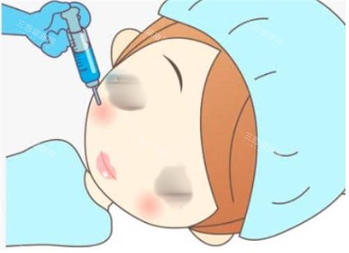 打针瘦脸手术过程图 打针瘦脸手术过程图