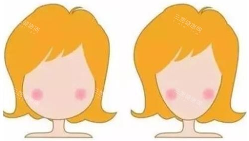 打针瘦脸明显对比图 打针瘦脸明显对比图