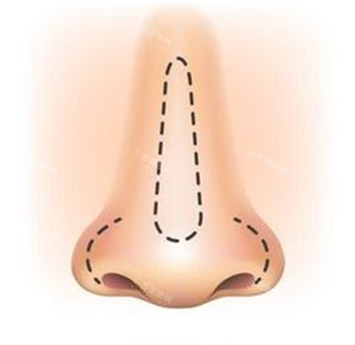 鼻子的卡通绘画图_副本 鼻子的卡通绘画图_副本