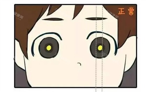 正常的眼睛 正常的眼睛