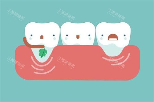 牙齿治疗过程卡通图