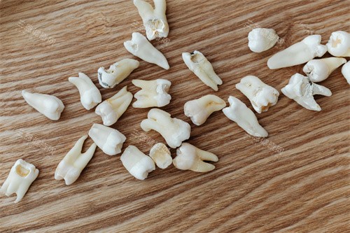 牙齿制作过程图片 牙齿制作过程图片