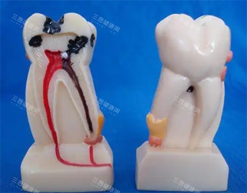 牙齿结构图解 牙齿结构图解