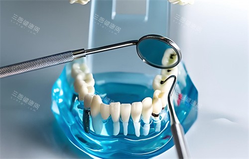 牙齿模型检查 牙齿模型检查