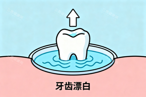 牙齿漂白卡通图 牙齿漂白卡通图