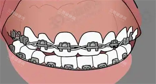 昆明家长必看！10家儿童牙齿矫正医院大推荐：德韩、美奥、尚爱韩美、松鼠、柏德哪家更适合你家宝贝？