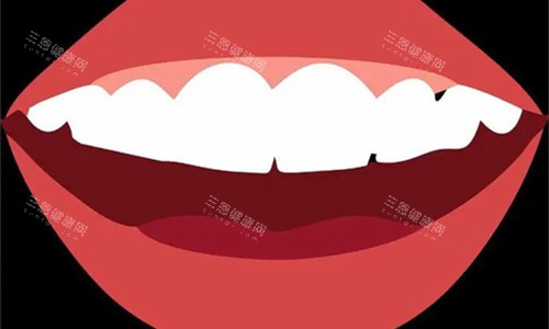 牙齿整齐卡通图 牙齿整齐卡通图