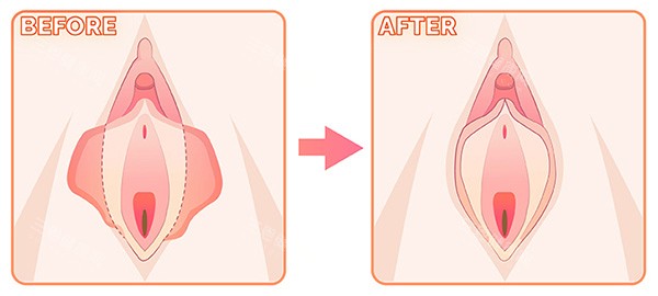 女性与入珠男亲密接触的体验如何？这种方式危害大吗？增大结果该怎么选？