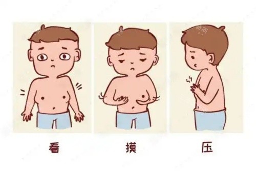 男性乳房发育吸脂前后对比图 男性乳房发育吸脂前后对比图
