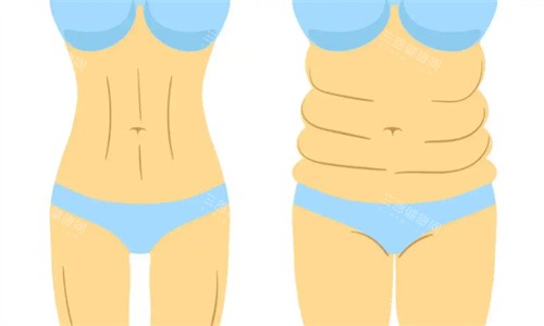 广州医科大学附属第一医院整形科价格表来了！眼鼻胸整形、吸脂、面部抗衰收费一目了然！