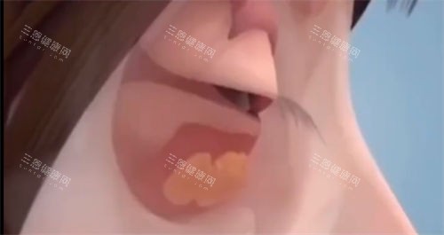 眼部鼓包动画展示图