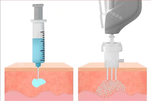 韩国清潭Mellow皮肤科体验分享：中韩统一收费，还有中文翻译服务太贴心了！