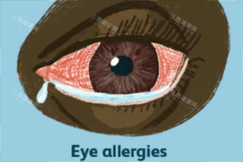 欣诺瞳防控眼镜真的靠谱吗？一文告诉你如何辨别真假，快速点击查看吧~